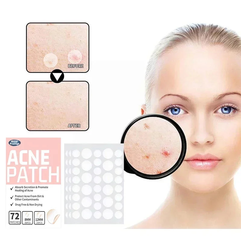 72/180Pcs Invisible Acne Patches Removal Pimple Anti-Acne Hydrocolloid Patches Spots Marks Concealer Repair Sticker Waterproof